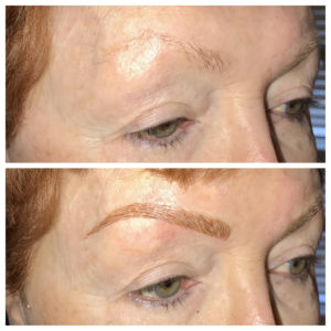 Microblading Before After on Woman
