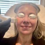 The Butterfly Effect: Transform Your Skin, Effortlessly
